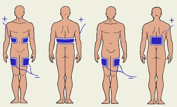 Galvanoplastie en cosmétologie - qu'est-ce que c'est, comment les procédures sont effectuées pour la peau autour des yeux, du visage et du corps, avantages et inconvénients, avantages. Appareil à usage domestique. Une photo