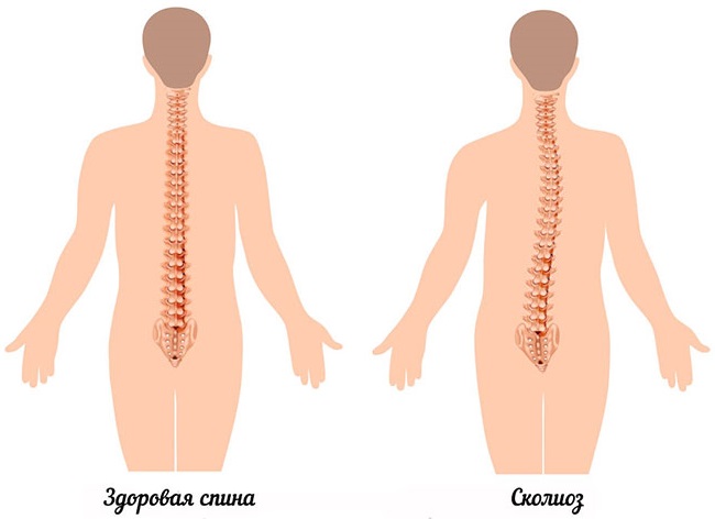 Comment pomper les muscles pectoraux à la maison pour une fille avec des haltères, des pompes, sur la barre horizontale. Programme de formation d'une semaine, un mois