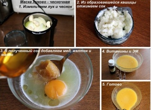 Masque à l'oignon pour la perte de cheveux. À quelle fréquence pouvez-vous préparer des recettes efficaces à la maison. Photos avant et après l'application