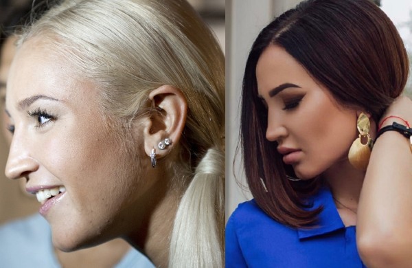 Olga Buzova - photos avant et après la chirurgie plastique du nez, des lèvres, des pommettes. Comment ai-je perdu du poids, quelle chirurgie plastique ai-je fait