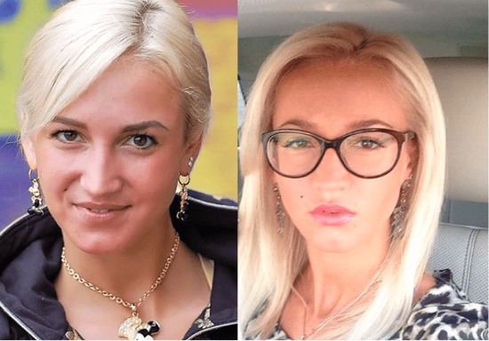 Olga Buzova - photos avant et après la chirurgie plastique du nez, des lèvres, des pommettes. Comment ai-je perdu du poids, quelle chirurgie plastique ai-je fait