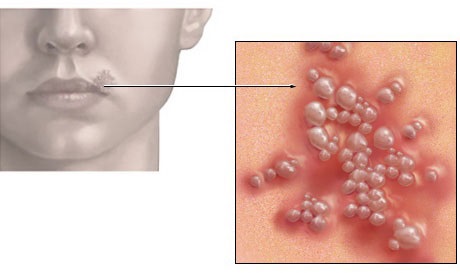 Exfoliants pour les lèvres. Comment le faire vous-même à la maison, lequel est préférable d'acheter, choisissez: Letual, Faberlik, Mac, comment utiliser. Commentaires