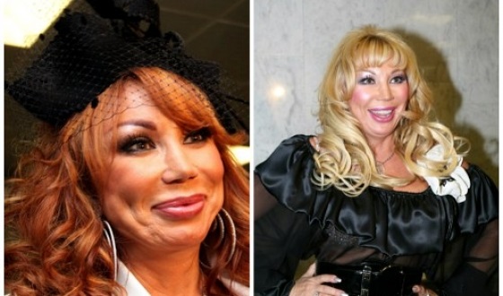 Chirurgie plastique infructueuse. Photos d'hommes et de femmes effrayantes de stars russes et hollywoodiennes