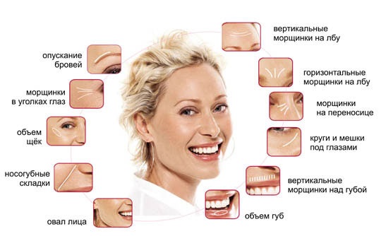 Juvederm hydrate pour la bio-revitalisation. Description du médicament, composition, mode d'emploi, résultats de la photo, prix, avis des cosmétologues