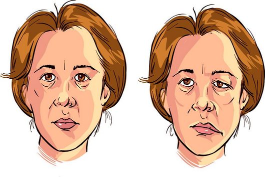 Massage facial buccal seul à la maison. Formation, technique de conduite étape par étape avec une photo