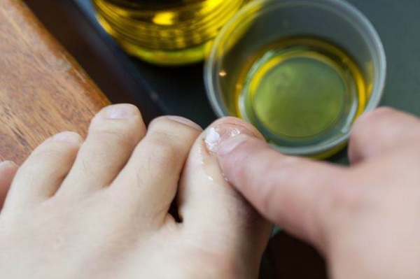 Comment renforcer les ongles pour qu'ils ne s'exfolient pas et ne se cassent pas à la maison La raison de la fragilité, comment traiter