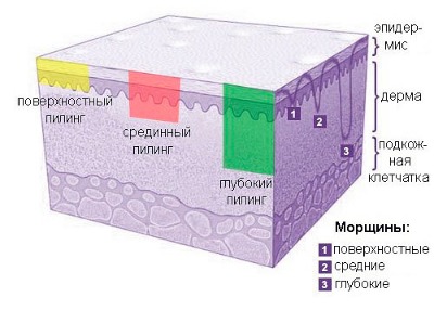 Mésothérapie et bio-revitalisation: quelle est la différence, les avantages et les inconvénients après le peeling, les indications et contre-indications