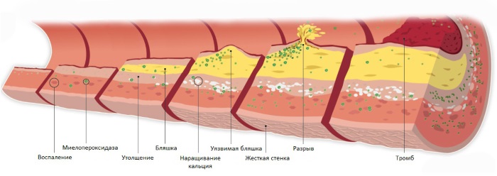 Chirurgie de réduction du nez: ailes, pointe, comment ça marche, photos avant et après