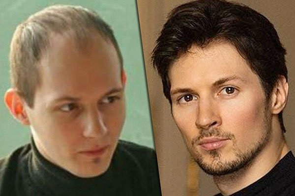 Pavel Durov. Photos avant et après la chirurgie plastique. À quoi ressemblait le créateur de Vkontakte, biographie et vie personnelle