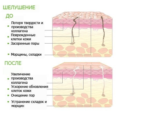 Peelings acides pour le visage: formulations professionnelles à usage domestique. Efficacité et utilisation