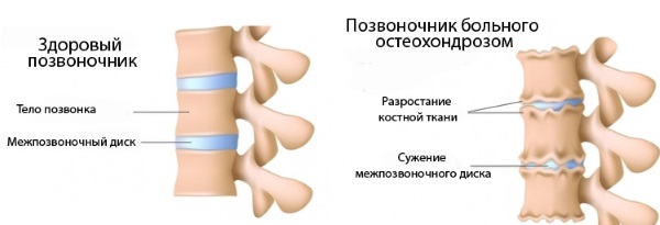 Rouleau arrière: genévrier, massage, sport, orthopédique, japonais, rouleau de fitness cylindrique