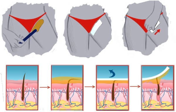 Épilation à la cire à la maison: zones de bikini, jambes, visage, règles de conduite, bandes de cire, boules, granulés, appareil, crèmes, mode d'emploi