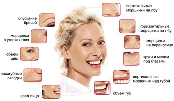 Chirurgie plastique faciale. Photos avant et après la chirurgie de contouring à l'acide hyaluronique. Prix, avis