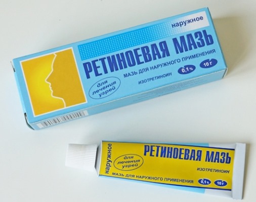 Comment se débarrasser des points noirs sur le visage, le nez, les oreilles. Produits avec acide salicylique, dentifrice, peroxyde, charbon actif