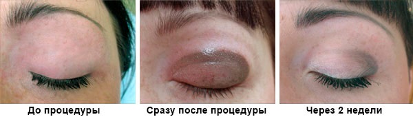 Maquillage permanent des ombres sur les paupières. Photo, comme pour les paupières inférieures et supérieures, avec ombrage, effet Smoky eyes, flèche classique