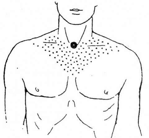 Points actifs biologiques sur le corps humain qui sont responsables d'organes. Technique de massage par acupuncture