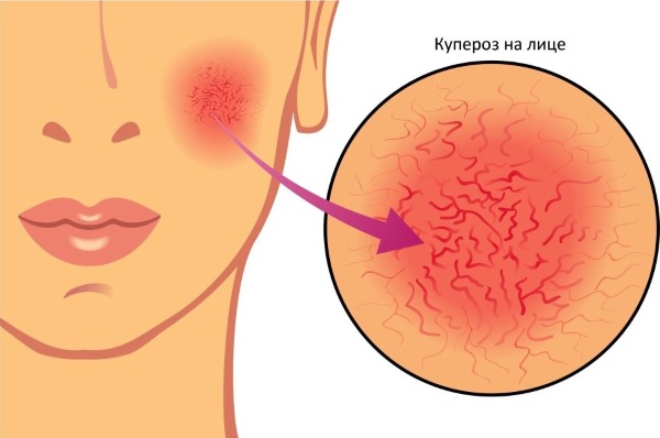 Crème cyclim pour le visage pour un effet botanique. Instructions d'utilisation, avis des cosmétologues. comment s'inscrire