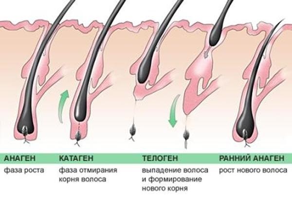 Comment arrêter la perte de cheveux chez les femmes. Causes après l'accouchement, l'allaitement, après 40 ans. Vitamines, alimentation, traitement à domicile