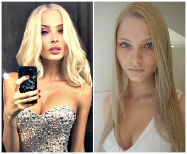 Alena Shishkova. Photos avant et après la chirurgie plastique. Biographie, opérations du modèle, paramètres de la figure