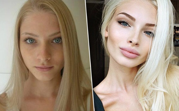 Alena Shishkova. Photos avant et après la chirurgie plastique. Biographie, opérations du modèle, paramètres de la figure