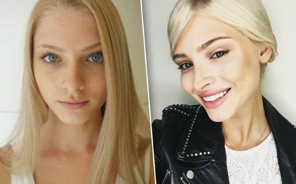 Alena Shishkova. Photos avant et après la chirurgie plastique. Biographie, opérations du modèle, paramètres de la figure