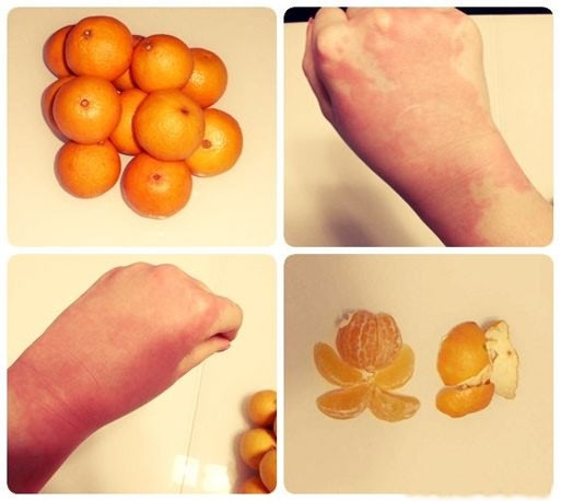 L'huile d'orange. Application pour les cheveux, les ongles, la peau du visage, la cellulite, les vergetures sur le corps. Comment faire du beurre à la maison