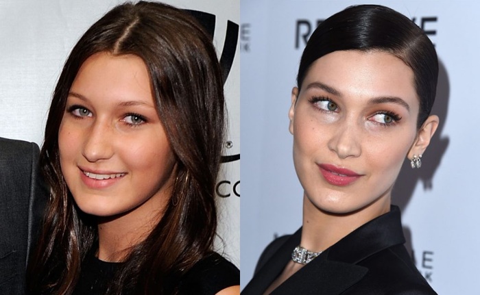 Bella Hadid avant et après la chirurgie plastique. Photo en maillot de bain, taille et poids, paramètres de forme, biographie, âge