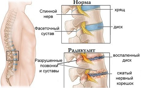 Darsonvalization - qu'est-ce que c'est en cosmétologie, les avantages de la procédure pour la peau du visage, de la tête, des paupières, des cheveux, des appareils. Indications et contre-indications, efficacité