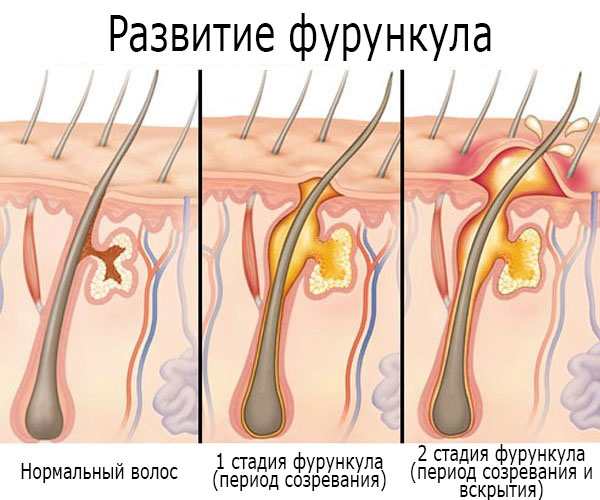 Darsonvalisation - qu'est-ce que c'est en cosmétologie, les avantages de la procédure pour la peau du visage, de la tête, des paupières, des cheveux, des appareils. Indications et contre-indications, efficacité