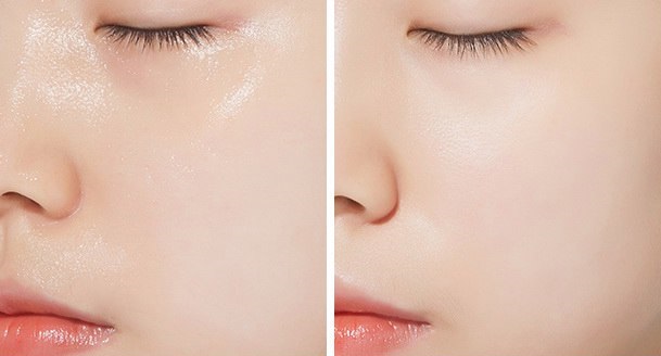 Peeling enzymatique: ce que c'est, bienfaits pour le visage: salicylique, acide. Comment choisir les meilleurs avis