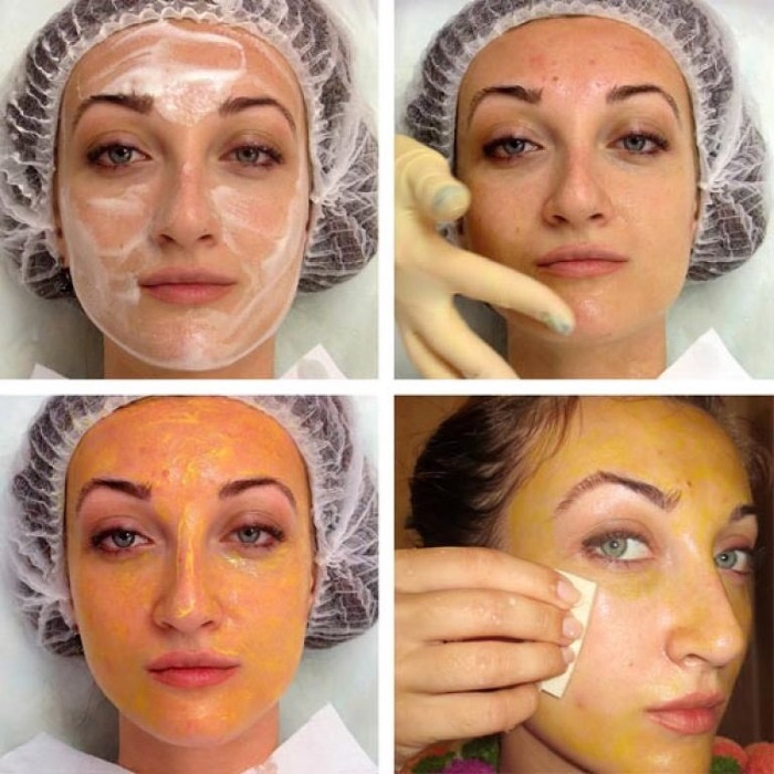 Peeling enzymatique: ce que c'est, bienfaits pour le visage: salicylique, acide. Comment choisir les meilleurs avis