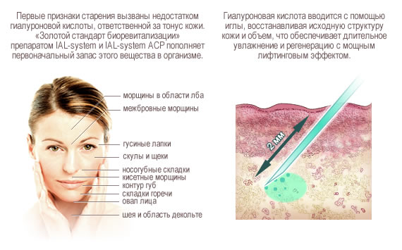 Gialripayer mesolift 02, 04, 06, 07, 08. Composition du bioréparant, prix, avis de patients, cosmétologues