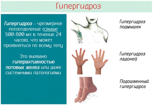 Comment se débarrasser de l'odeur de sueur sous les bras. Remèdes populaires pommades, pâtes et sprays pour la transpiration excessive