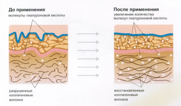 Collagène pour le visage, le cou et le décolleté. Cosmétiques: gels, crèmes, sérums, shampoing, masque. Comment utiliser capsule, liquide, buvable