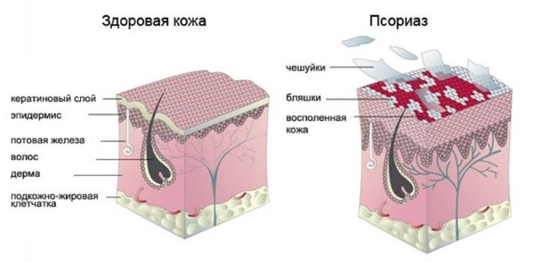 Comment utiliser Levomekol pour l'acné sur le visage. Instructions, indications et contre-indications