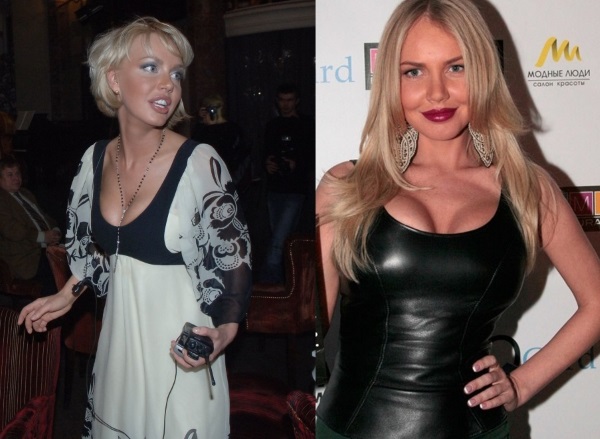 Masha Malinovskaya avant et après la chirurgie plastique. Photo, âge, taille et poids