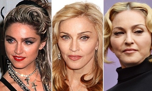 Top 10 des stars de la chirurgie plastique qui n'ont pas réussi. Photos avant et après les acteurs soviétiques, russes, étrangers, hollywoodiens