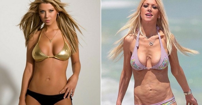 Top 10 des stars de la chirurgie plastique qui n'ont pas réussi. Photos avant et après les acteurs soviétiques, russes, étrangers, hollywoodiens