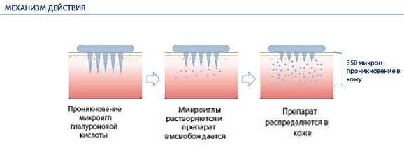 Patchs oculaires - qu'est-ce que c'est, composition, comment l'utiliser. Classement des meilleurs: cosmétiques coréens, hydrogels, collagène, or