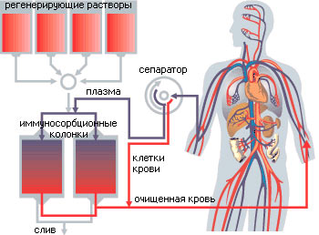 Plasmaphorèse - indications d'utilisation en gynécologie, grossesse, allergies, psoriasis. Effets secondaires possibles, coût de la procédure