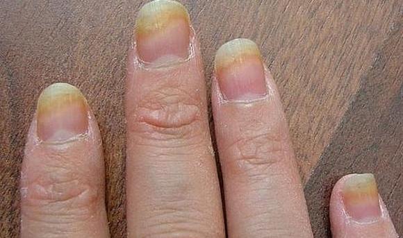 Apprêt pour les ongles - de quoi s'agit-il, types, recommandations de sélection et d'utilisation. Top marques