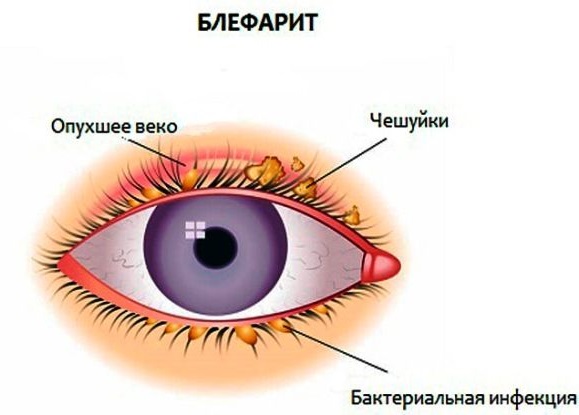 Moyens pour la croissance des cils en pharmacie: huiles, sérums, biogel. Comment renforcer les cils et améliorer leur croissance