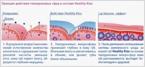 Augmentation des lèvres à la maison: recettes de masques, gommages, acide hyaluronique, nicotinique. Exercice, massage, aspiration