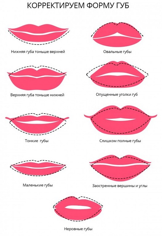 Augmentation des lèvres avec de l'acide hyaluronique, des charges, du botox, du silicone, des plastiques de contour. Photo, prix, avis