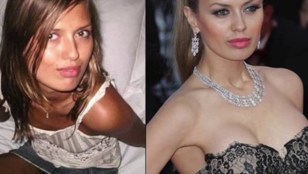 Victoria Bonya avant et après la chirurgie plastique - photo, vie personnelle, taille, poids. Nouvelle chirurgie plastique