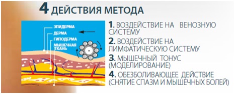 Thérapie d'endosphère - qu'est-ce que c'est, revues de massage, résultats, prix. Appareils de correction de la cellulite