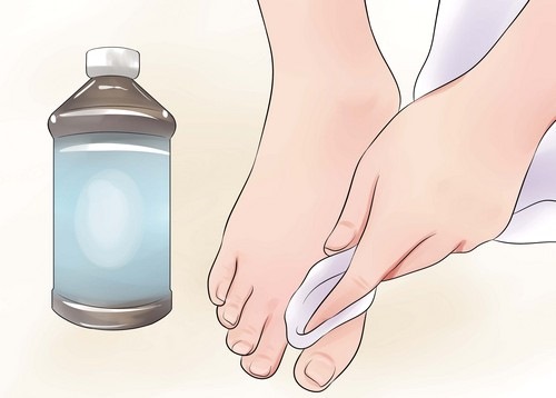 Comment se débarrasser efficacement des odeurs de pieds. Meilleurs remèdes dans les pharmacies, causes et traitements de la transpiration