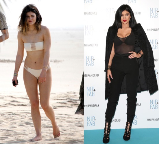 Kylie Jenner avant et après la chirurgie plastique: photos sans maquillage, photoshop, en maillot de bain, enceinte. Quel âge, hauteur, paramètres, biographie