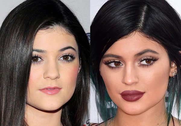 Kylie Jenner avant et après la chirurgie plastique: photos sans maquillage, photoshop, en maillot de bain, enceinte. Quel âge, hauteur, paramètres, biographie