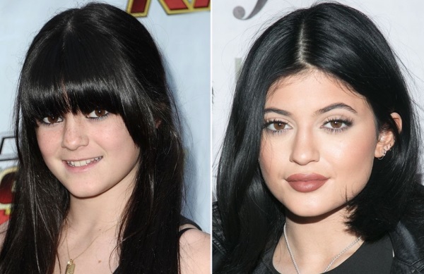 Kylie Jenner avant et après la chirurgie plastique: photos sans maquillage, photoshop, en maillot de bain, enceinte. Quel âge, hauteur, paramètres, biographie